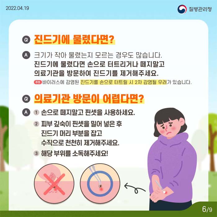 Q 진드기에 물렸다면?
A 크기가 작아 물렸는지 모르는 경우도 많습니다.
  진드기에 물렸다면 손으로 터트리거나 떼지 말고 의료기관을 방문하여 진드기를 제거해 주세요