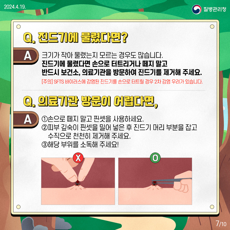 Q 진드기에 물렸다면
A 크기가 작아 물렸는지 모르는 경우도 많습니다.
진드기에 물렸다면 손으로 터트리거나 떼지말고 반드시 보건소, 의료기관을 방문하여 진드기를 제거해 주세요
(주의) SFTS바이러스에 감염된 진드기를 손으로 터트릴 경우 2차 감염 우려가 있습니다.
Q 의료기관 방문이 어렵다면,
A 1. 손으로 떼지 말고 핀셋을 사용하세요
2. 피부 깊숙이 핀셋을 밀어 넣은 후 진드기 머리 부분을 잡고 수직으로 천천히 제거해 주세요
3. 해당 부위를 소독해 주세요