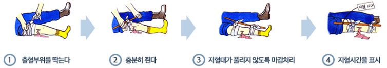 1.출혈부위를 닦는다. 2.충분히 조인다. 3.지현대가 풀리지 않도록 마감처리. 4.지혈시간을 표시. 지혈대 이용 지혈 절차에 대한 이미지